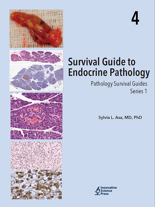 Survival-4-Endocrine