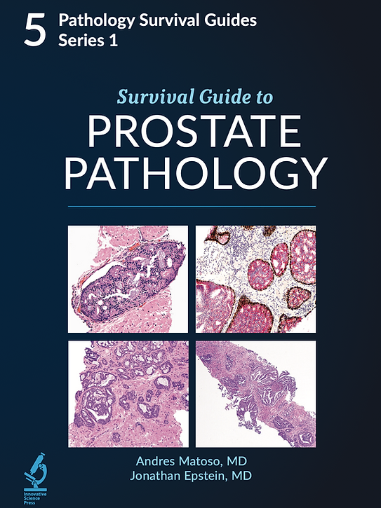 Survival-5-Prostate